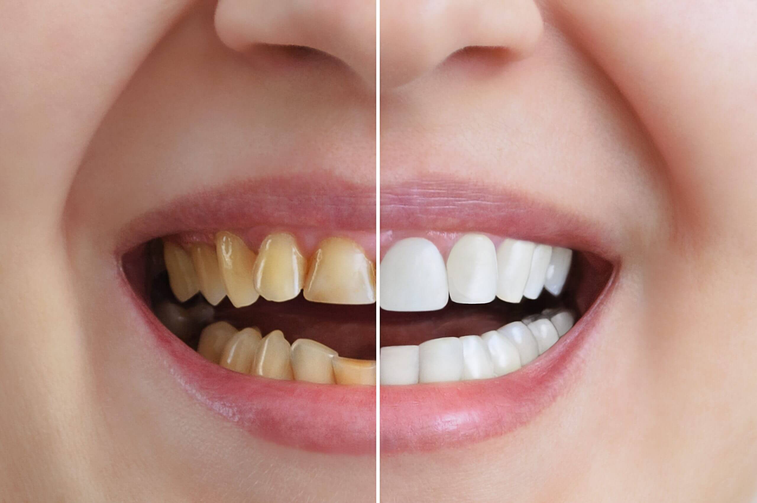 The Secret to a Spectacular Smile: Discover the 5 Key Treatments at Amatista